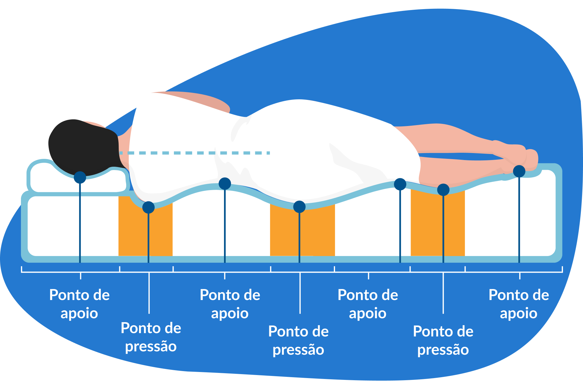 ilustração de uma pessoa deitada de lado, com os pontos de alívio e pontos de pressão devidamente alinhados.
